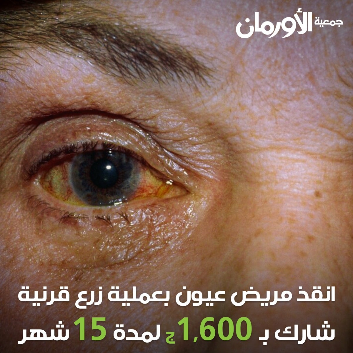 الخبر